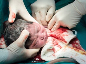 Caesarean birth