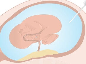 Diagnostic tests